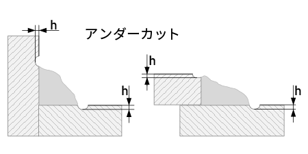 アンダーカットの測定